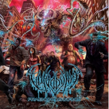 Vulvodynia - Praenuntius Infiniti