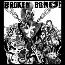 Broken Bones - Dem Bones
