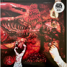 200 Stab Wounds - Manual Manic Procedures