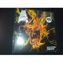 200 Stab Wounds - Piles of Festering Decomposition