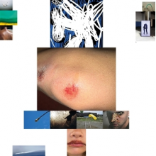 Helfenstein, Remo - Spite