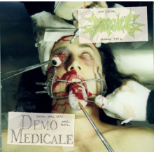 Impaled - Demo Medicale